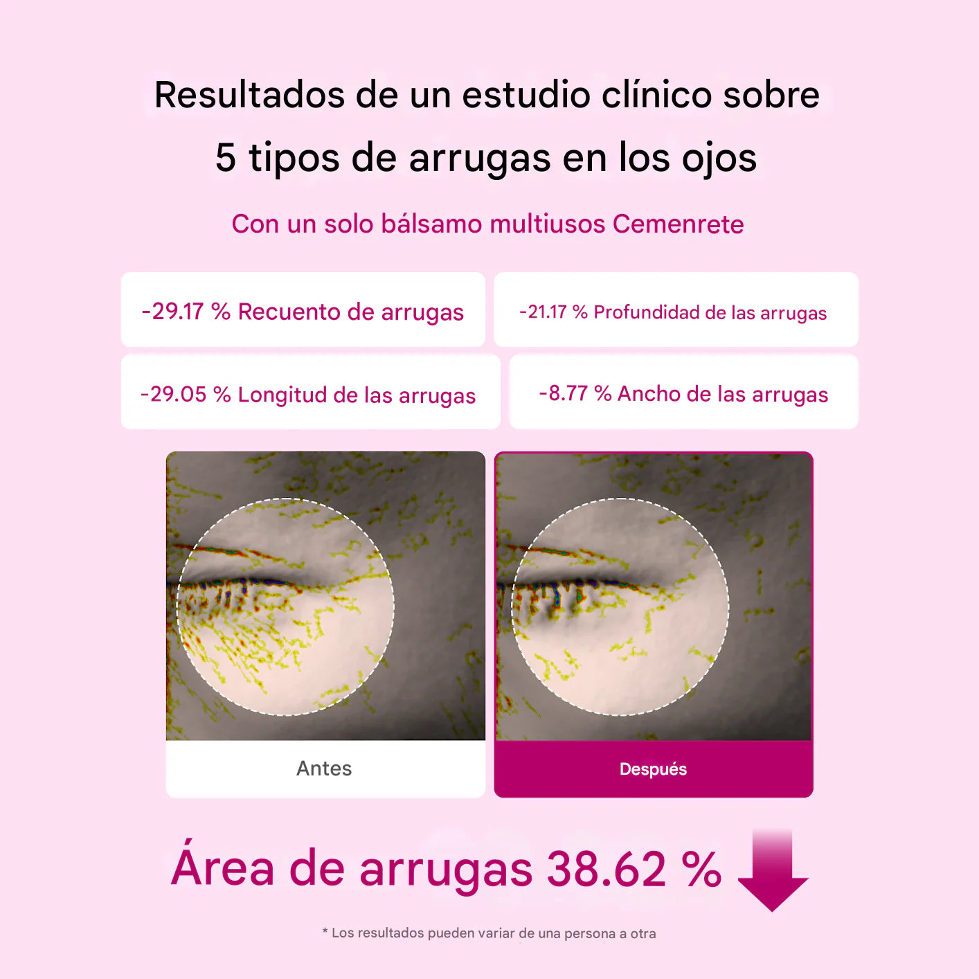 Bálsamo Anti-Arrugas Solvia