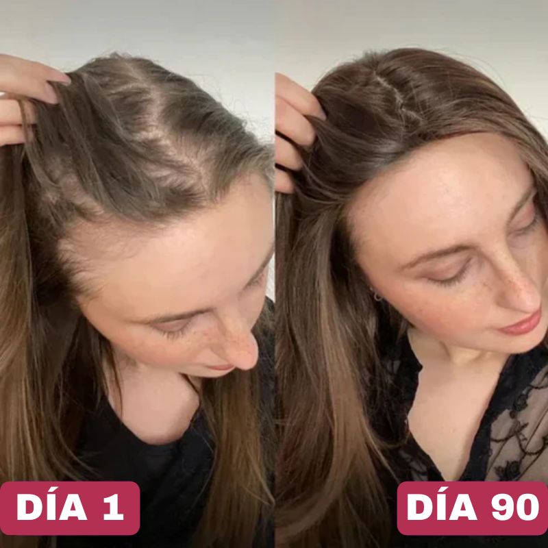 Multivitamínico Líquido Anti Caída Cabello Solvia