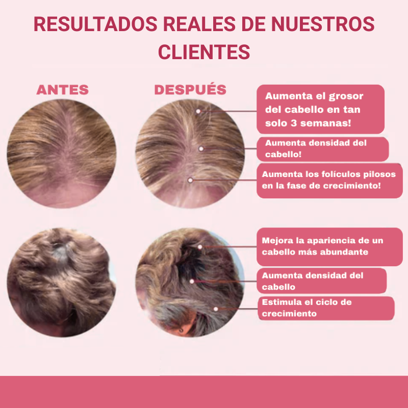 Multivitamínico Líquido Anti Caída Cabello Solvia