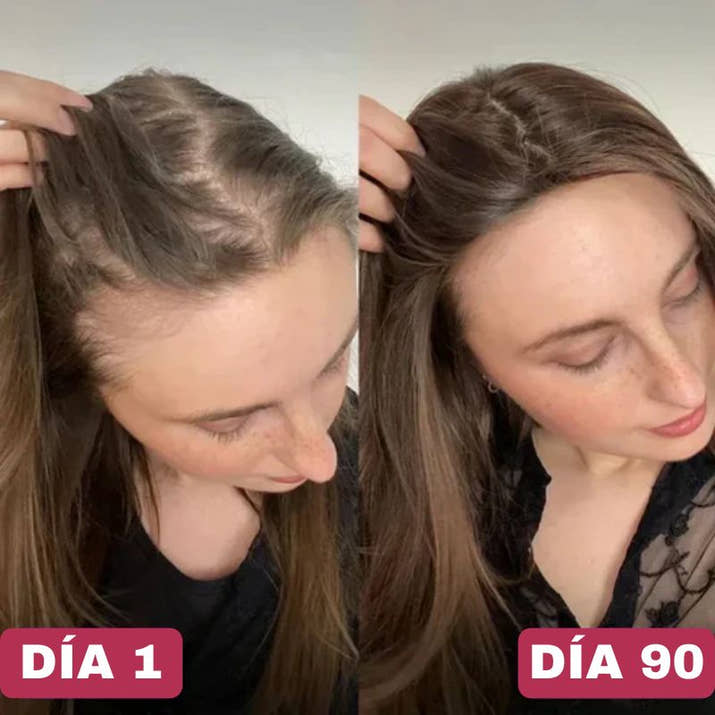 Multivitamínico Líquido Anti Caída Cabello Solvia