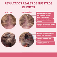 Multivitamínico Líquido Anti Caída Cabello Solvia